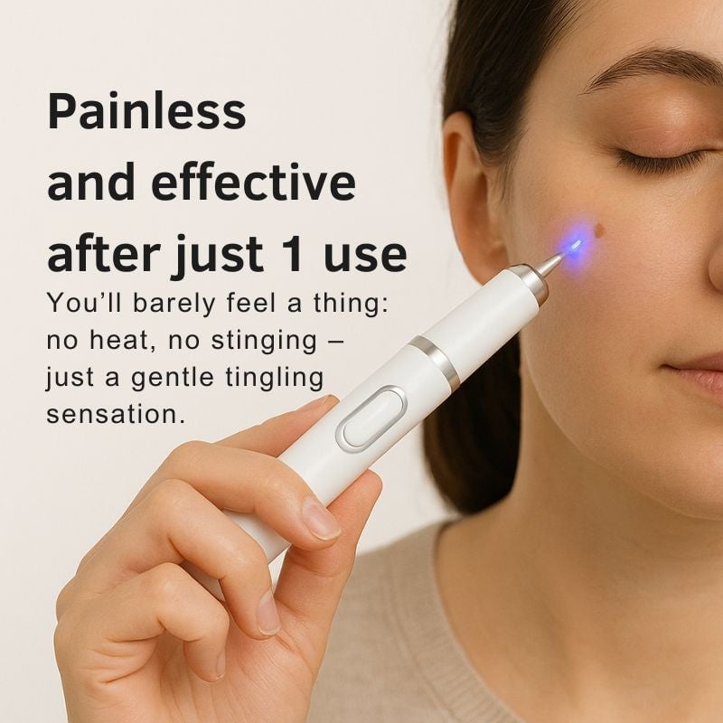Laser Pen | Removes Warts & Moles in Just 2 Days!