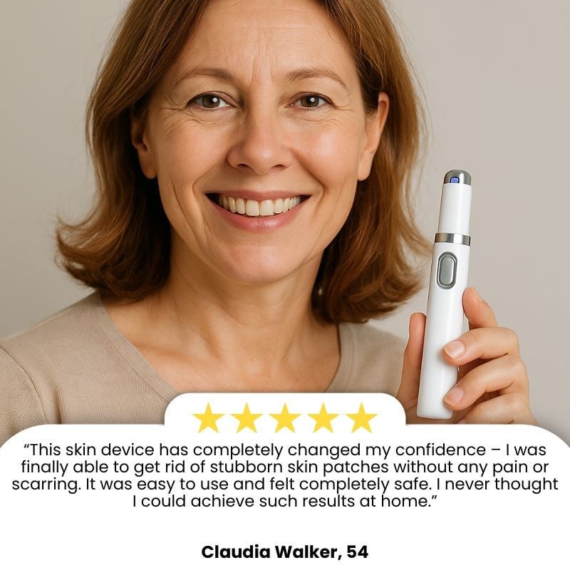 Laser Pen | Removes Warts & Moles in Just 2 Days!